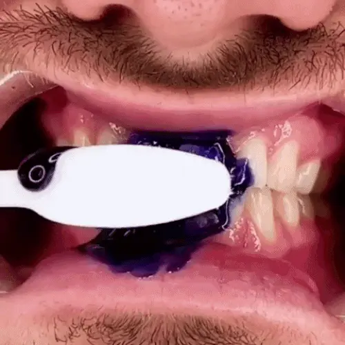 1- Dents blanches brillantes sans causer d'irritation de la bouche.