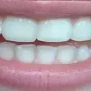 SSA36