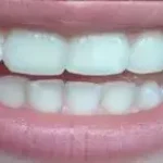 SSA36